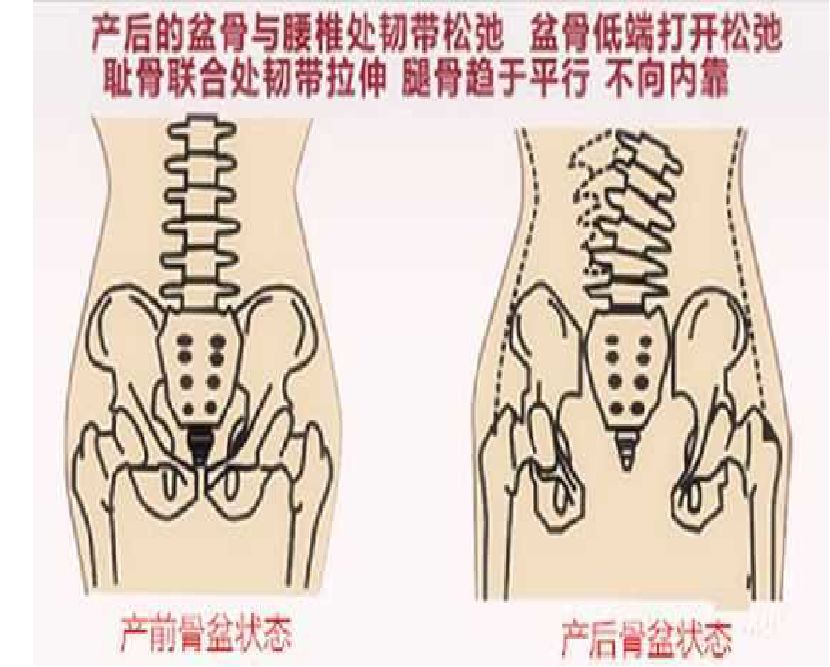 美容项目的另一桶金--产后康复师